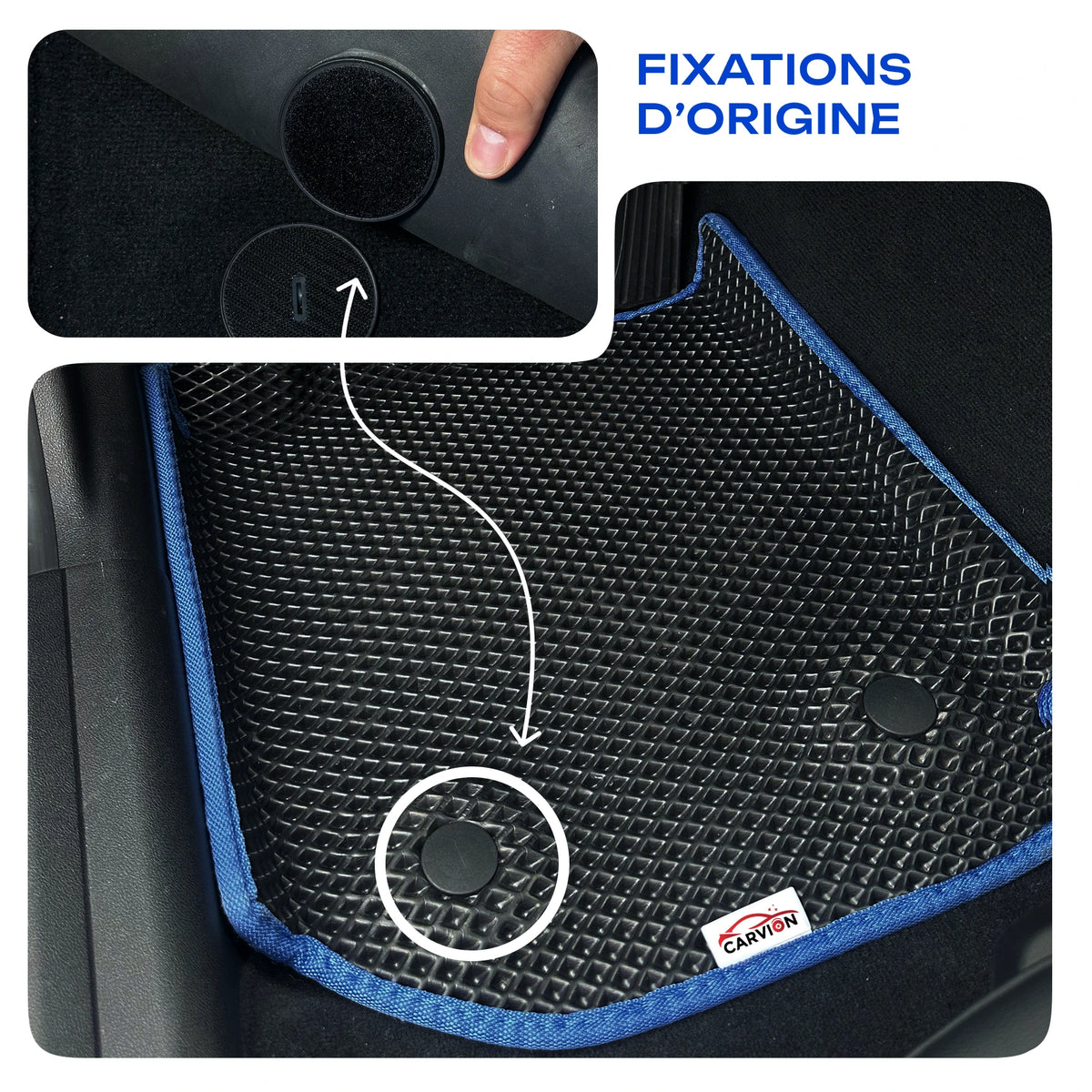 Fixations d’origine